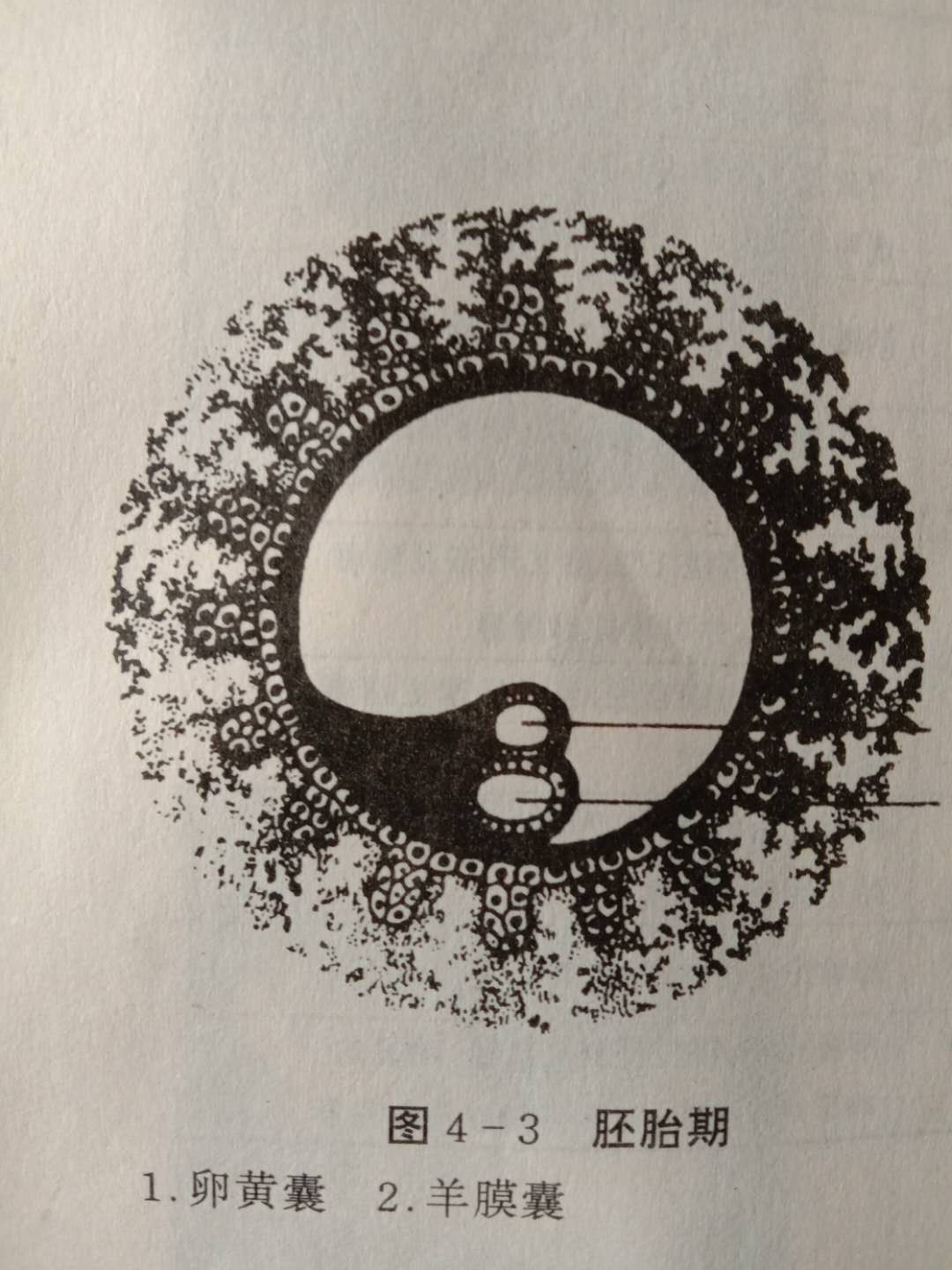 药物流产得多长时间才能流下来,药物流产后怎么判断是否流干净