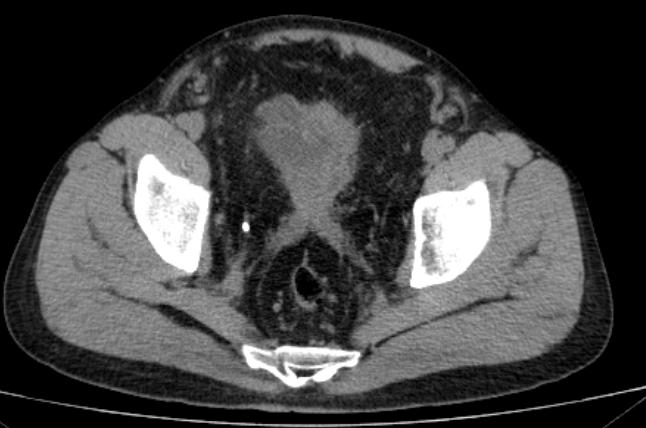 omg鑴傝偑,omg涓轰粈涔堥暱鑴傝偑