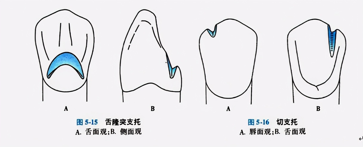 牙列缺损的可摘局部义齿修复题库,牙科美学修复精讲