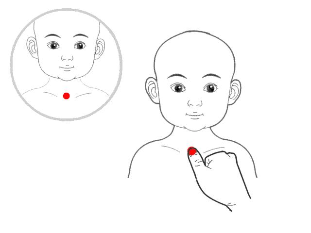 老师的孩子老是反复咳嗽怎么办,曲黎敏老师讲的治咳嗽的方法