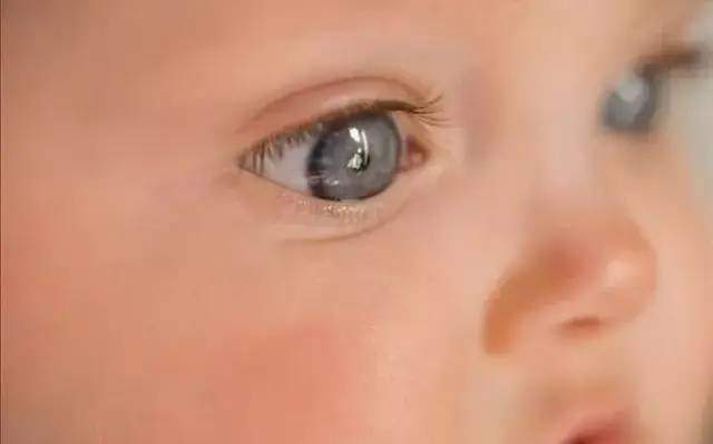 孩子眼屎突然特别多用什么药,孩子出现眼屎多眼袋肿