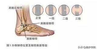 跑步受伤恢复后的感言,受伤后跑步恢复训练