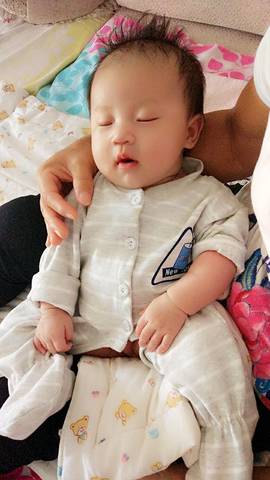 普及！宝宝湿疹不敢用药怕激素？湿疹护理指南来帮你