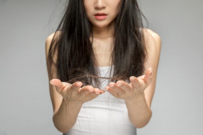 南宁年轻人经常脱发怎么办,这三种典型脱发90%的人都能治