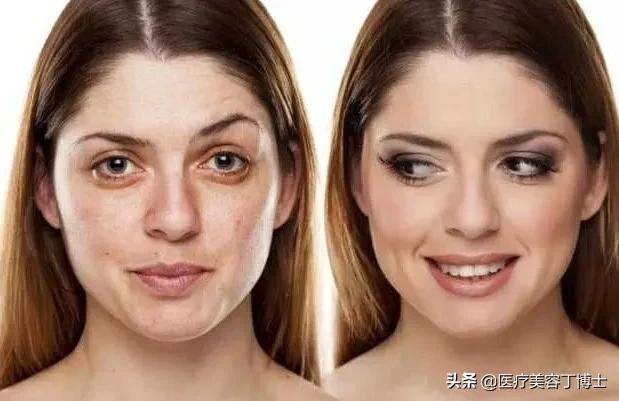 毛孔粗大皮肤又干是什么肤质,毛孔粗大的克星怎么解决