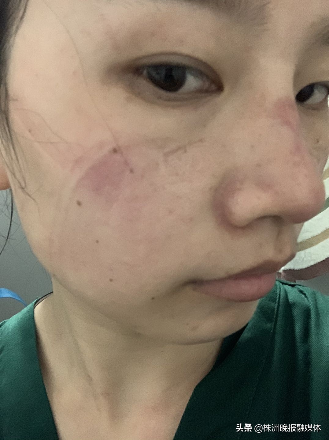 你脸上的印是什么,你脸上的皱纹是微笑留下的印记