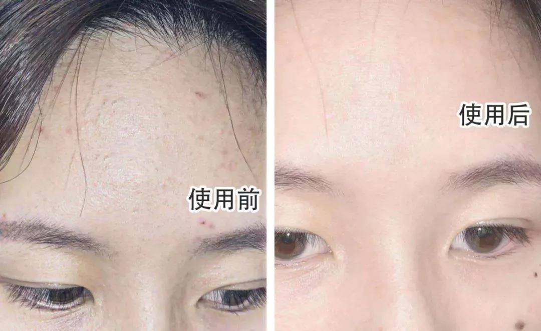 去角质死皮洁面慕斯,去角质死皮慕斯