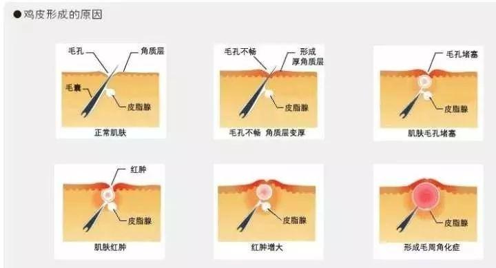 这些不靠谱的护肤方式你可别乱试,这些烂脸护肤误区你可千万不要犯