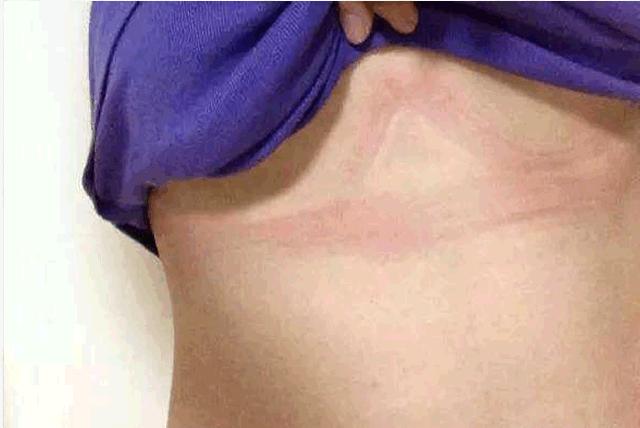 乳胶文胸解说,乳胶文胸注意事项