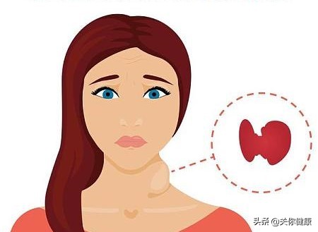 女性水肿怎么回事,女性内分泌失调会不会导致水肿