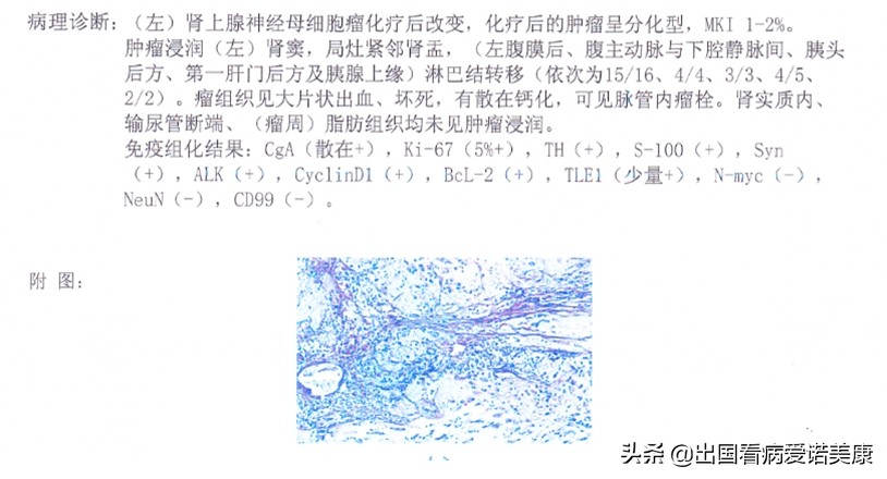 我带6岁孩子去英国治疗癌症的经历