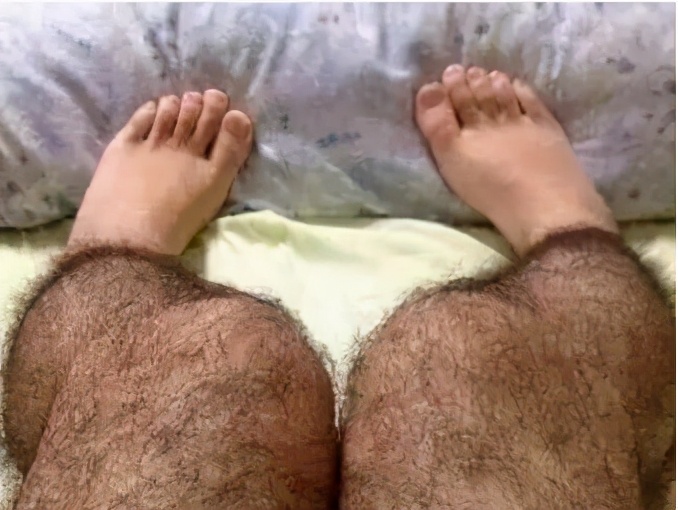 脱毛膏和蜜蜡脱毛哪个比较好,不用蜜蜡脱毛膏脱毛仪器如何脱毛