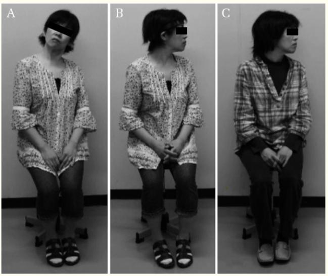 衣架套在头上会转是真的吗,衣架反射是真的吗