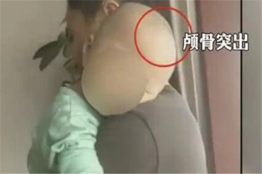 大头娃娃奶粉事件详解,大头娃娃假奶粉处理