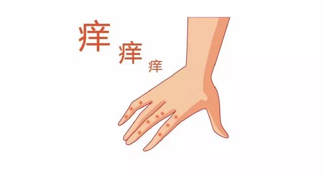 脚气的水泡会传染到手上吗,手上起小水泡会传染别人吗