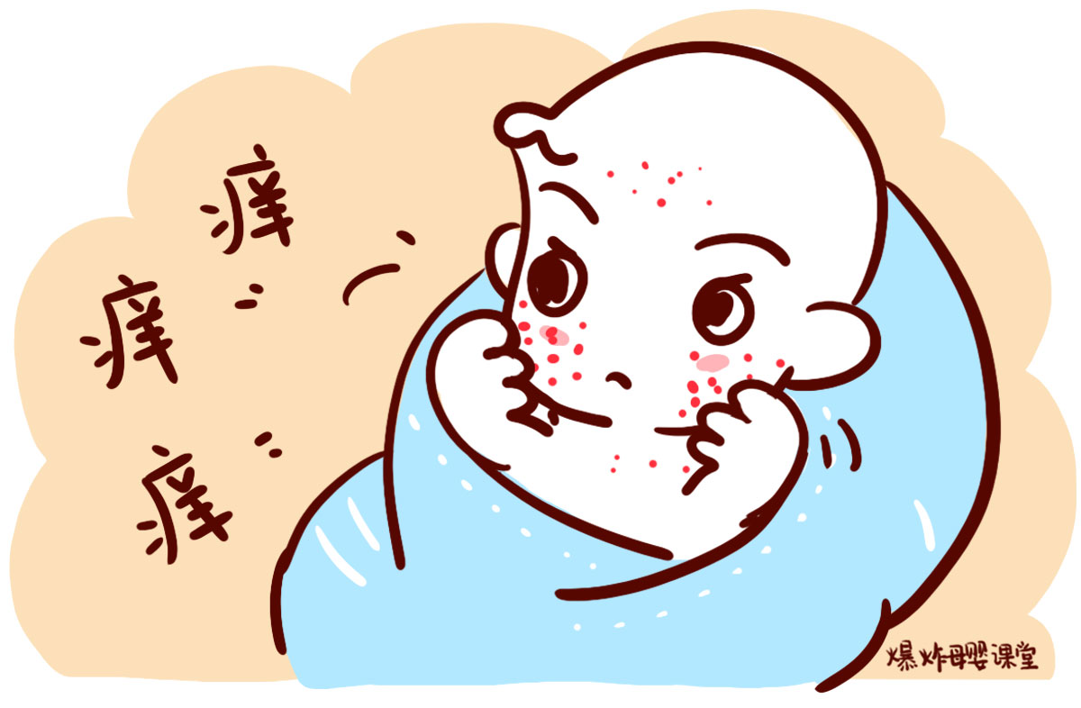 护理水痘病人怎样才不会被传染,出水痘要注意什么怎么样护理