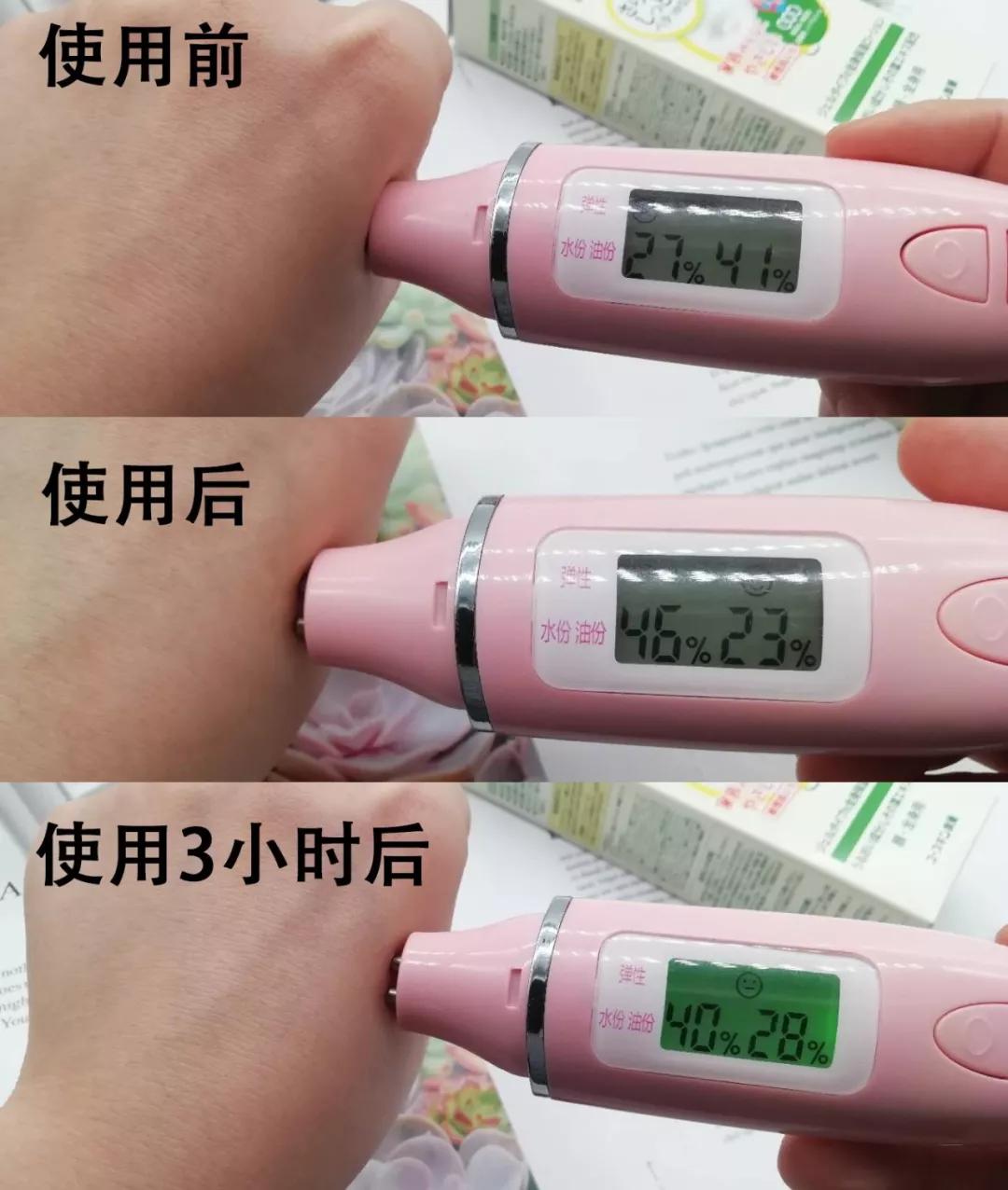 日本抗痘护肤品牌,日本护肤品淡斑美白排行榜