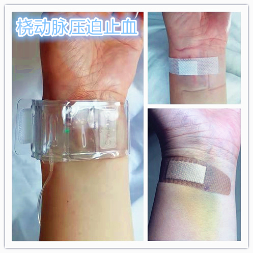 子宫肌瘤介入栓塞对子宫影响,子宫肌瘤介入栓塞治疗的危害