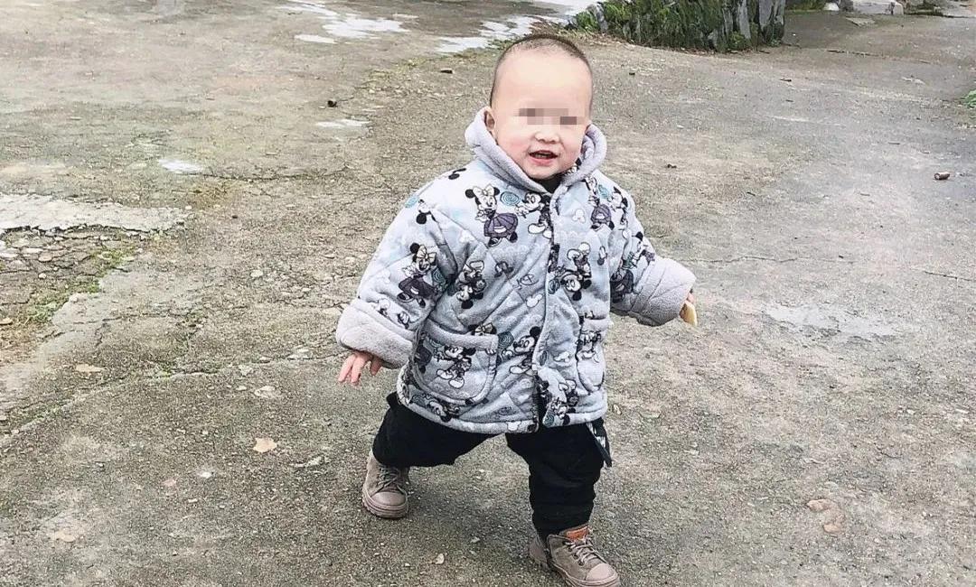 七个月的宝宝大面积烫伤警察帮助,小孩被火锅烫伤后怎么处理