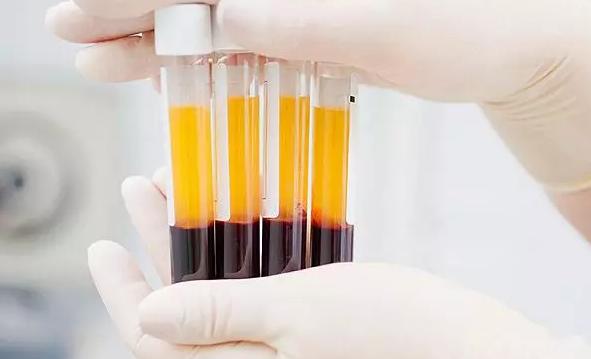 血浆治疗能救命吗,血浆疗法是唯一治疗方案吗