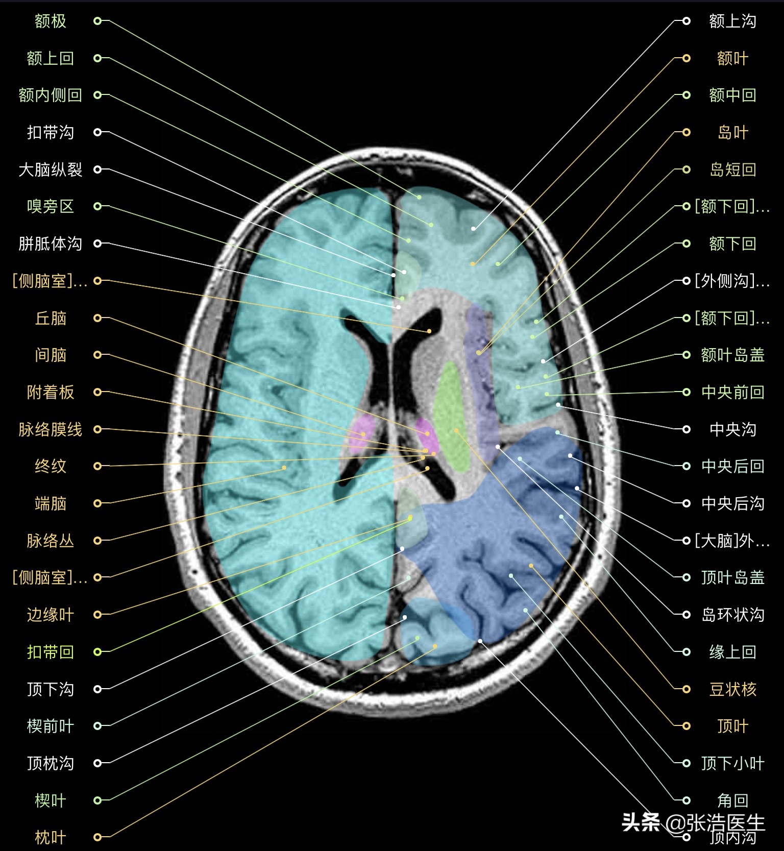 颅脑mri断层解剖视频课件,颅脑mri解剖手绘图