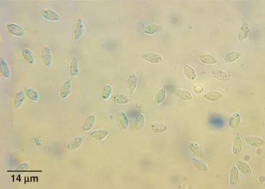 猫感染球虫滴虫用什么驱虫药,猫咪球虫滴虫怎么治疗最有效