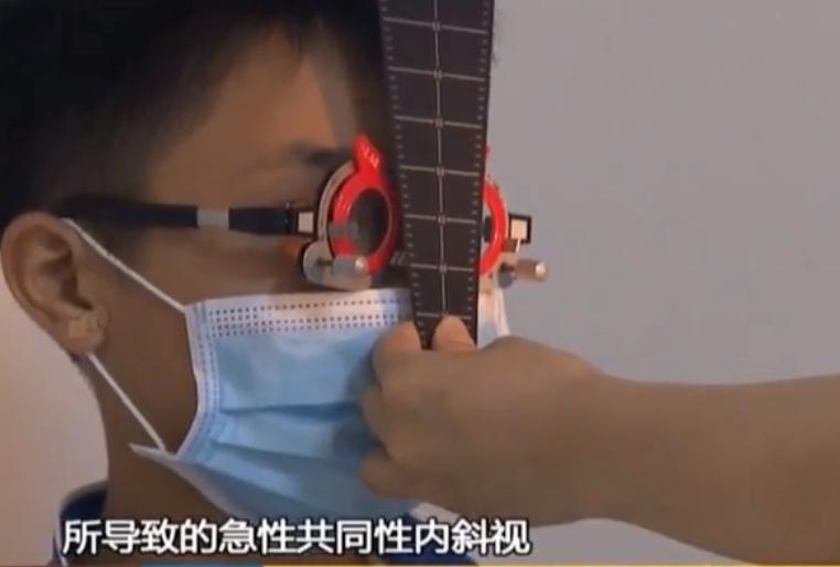 一小孩变斗鸡眼,小孩突然成斗鸡眼