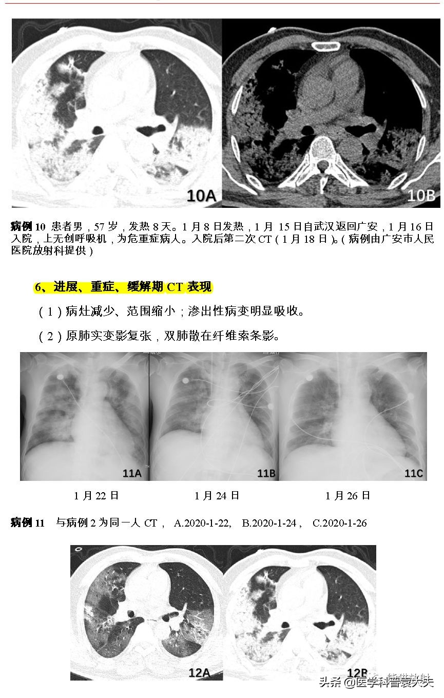 最新新型冠状病毒肺炎的指南,最新新型冠状病毒肺炎防控指南