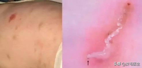 猫狗之间互相传染的病,猫狗耳螨互相传染怎么根治