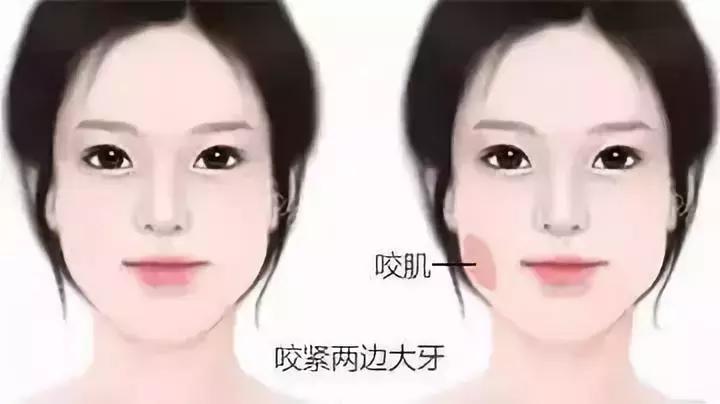 国产跟进口的瘦脸针的区别,国产瘦脸针跟进口的有啥区别