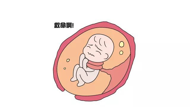 脐带绕颈一周怎么办需要注意什么,脐带绕颈有危险吗怎么处理