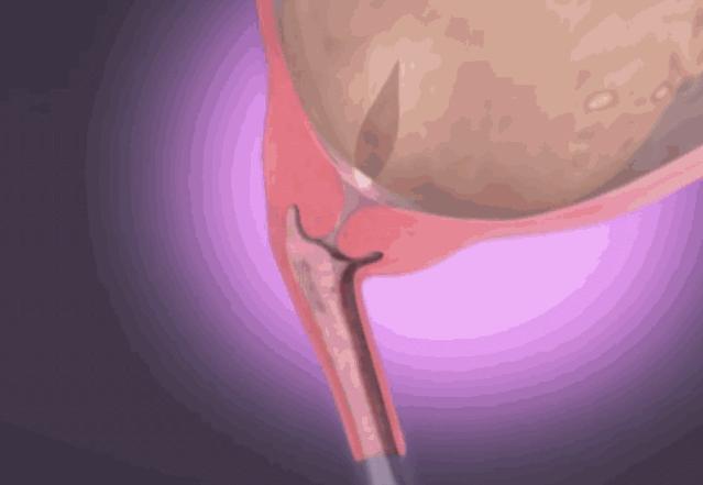 3D实图还原女性分娩全过程，没有一个妈妈能笑着看完