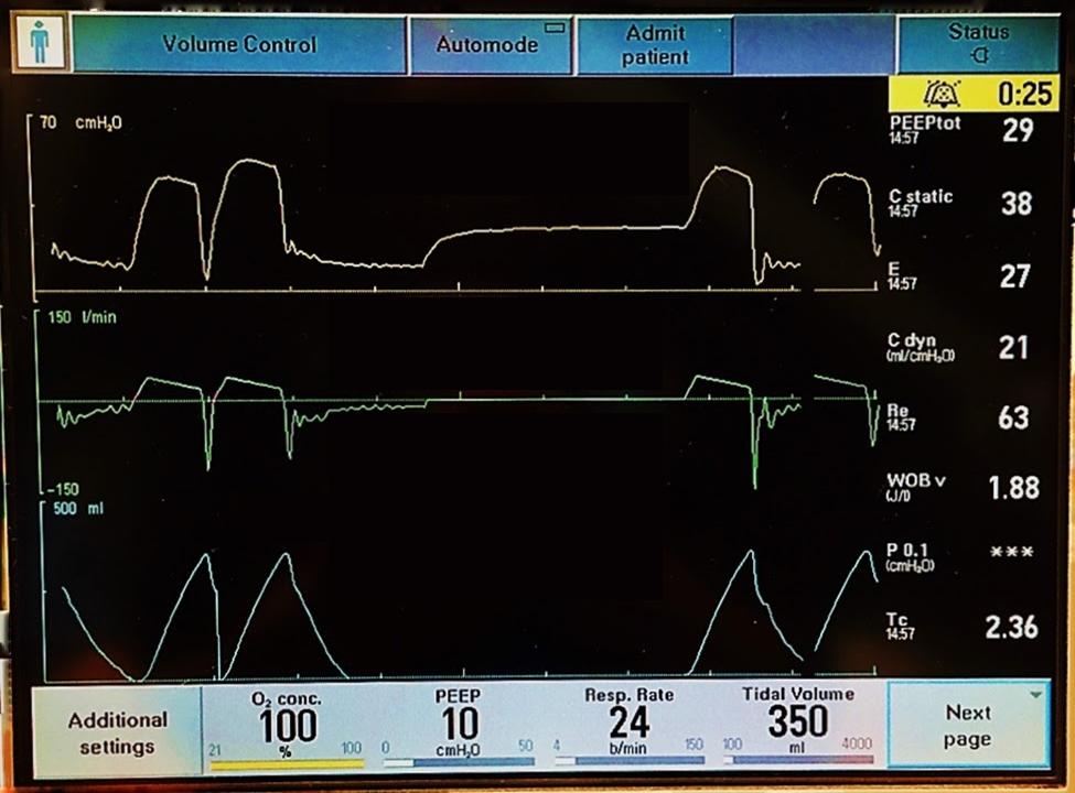 新冠肺炎机械通气系列课程(讲义)-阻塞性肺病的机械通气