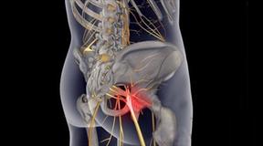 坐骨神经痛是糖尿病引起的吗,被糖尿病并发症吓到