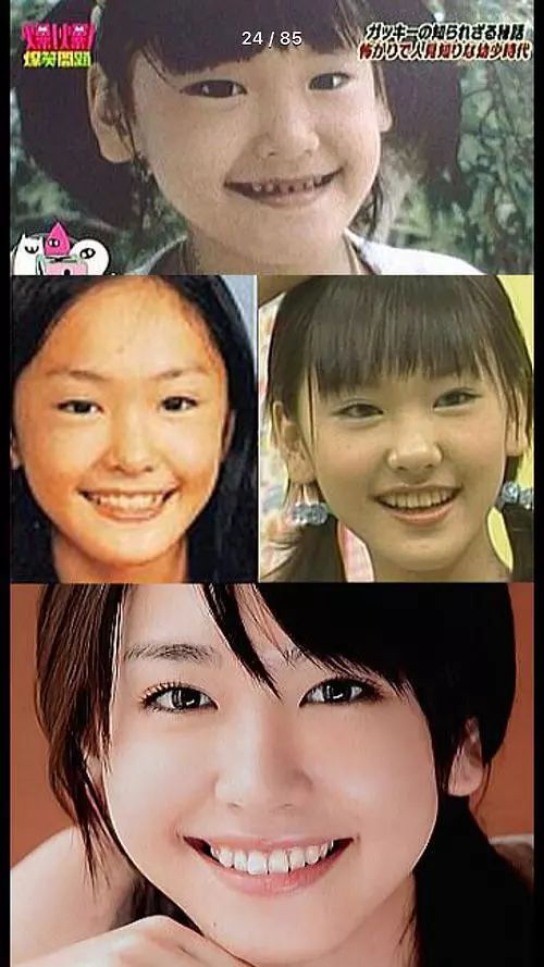 日本水原希子整容,水原希子真的整容了吗