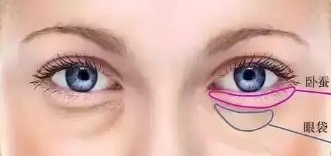 卧蚕和眼袋到底怎么区分？