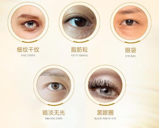 眼袋眼纹黑眼圈改善方法,去黑眼圈眼袋眼纹最有效的小妙招
