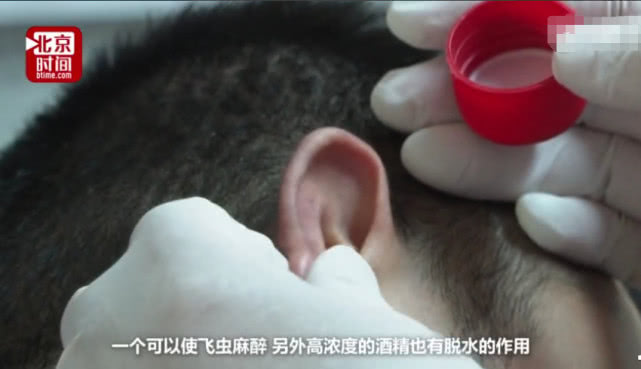 苍蝇飞进耳朵挣扎一会没动静了,苍蝇飞进小伙耳道医生妙招取出