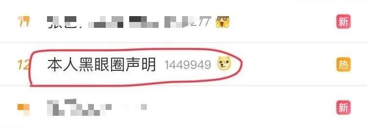 你的黑眼圈是哪种,你的黑眼圈怎么形成的