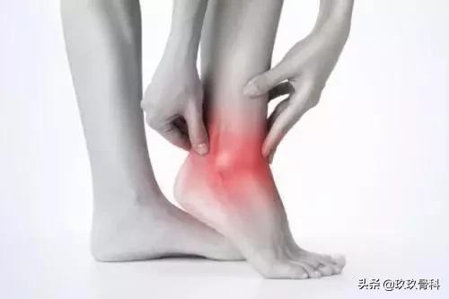 脚踝扭伤一个月后康复训练法,脚踝扭伤是否需要康复训练