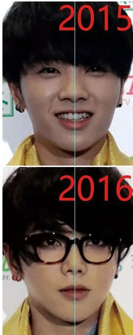 为什么华晨宇植发效果好,华晨宇植发图片是真的吗