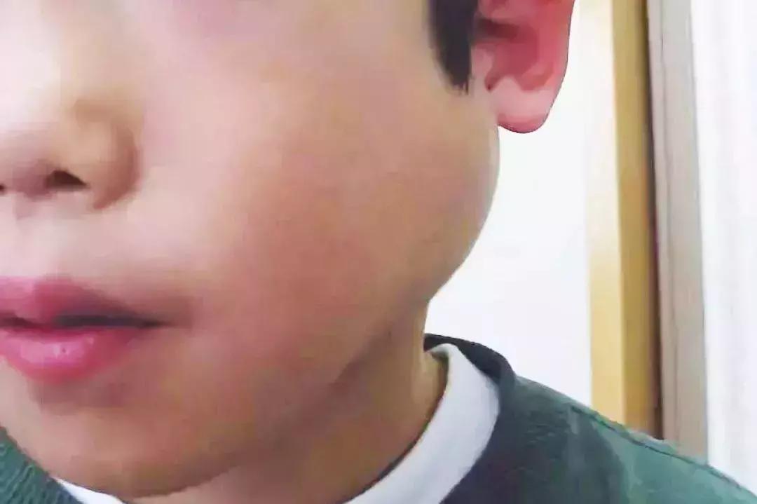 春季是各种传染病的高发季,春季是传染病的高发期吗