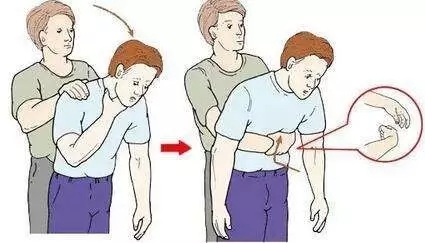 婴儿误食异物噎住,宝宝误吞异物怎么安慰