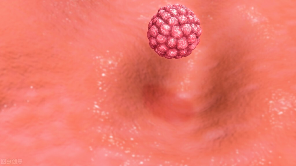 附件炎是造成输卵管卵巢感染的常见妇科疾病