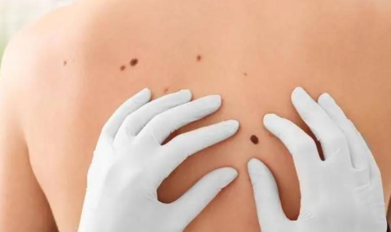 下一个可能攻克的癌症疫苗,德国抗癌疫苗最新消息何时临床