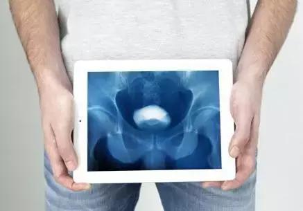 男性小腹痛吃什么消炎药,小腹痛男性坐着就没事了