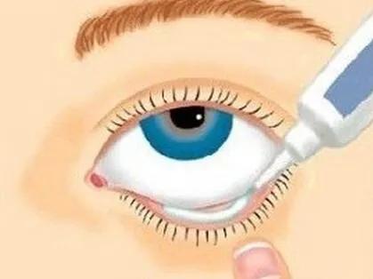 厦门女子把鸡眼药水当“眼药水”，差点失明