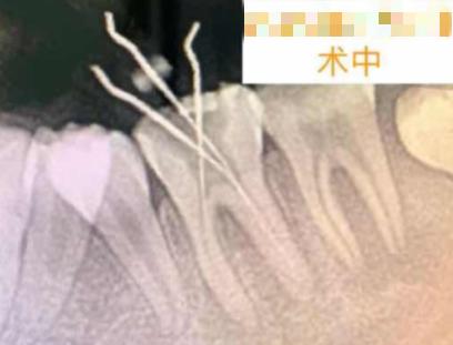 园园援藏记（二）|高原筑梦