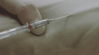 水痘高发期提醒信息,什么季节容易得水痘