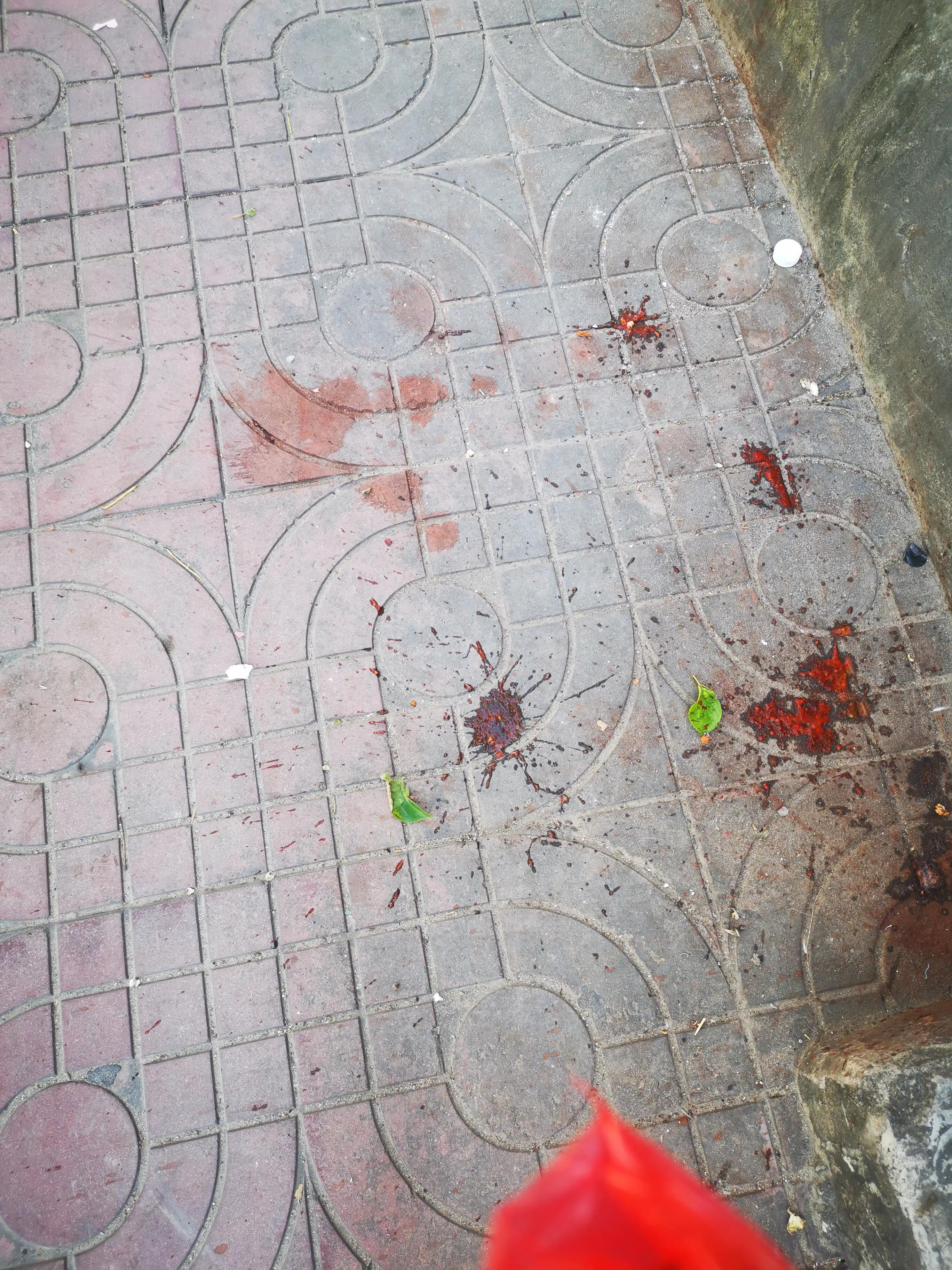 吃槟榔之后怎么恢复,吃槟榔之后口腔能恢复吗